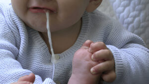 Vomiting after feeding
